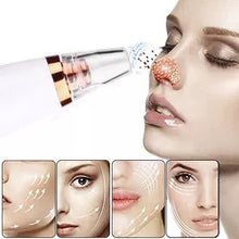 Cargar imagen en el visor de la galería, Succionador de poros- Limpieza profunda y piel renovada
